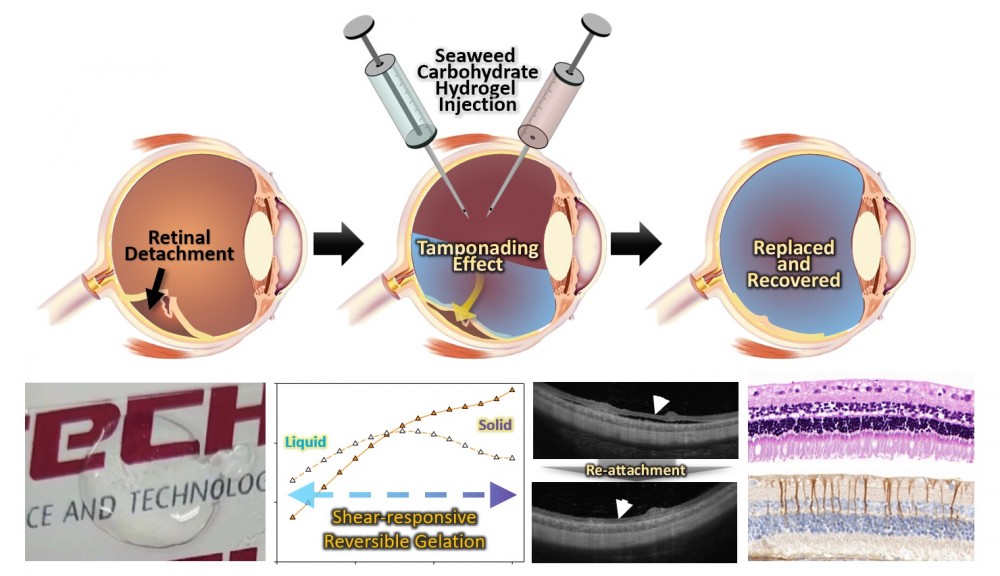 Injectable alginate-based in situ self-healable transparent hydrogel as ...